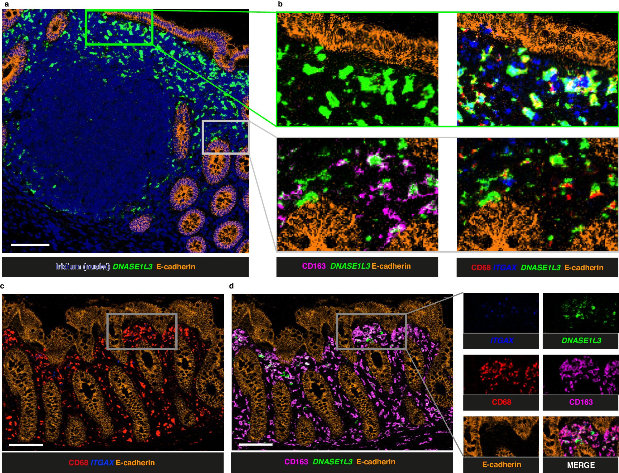 Cell types and molecules commonly associated with autoimmune diseases appear to be normal components of intestinal immunity