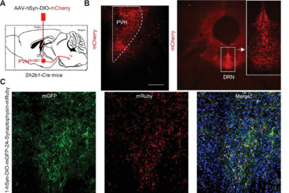 How an obesity gene affects the brain