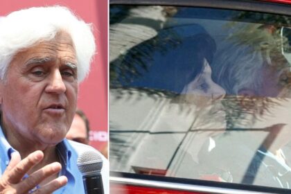 Jay Leno's wife caught with a black eye after being diagnosed with 'severe dementia'