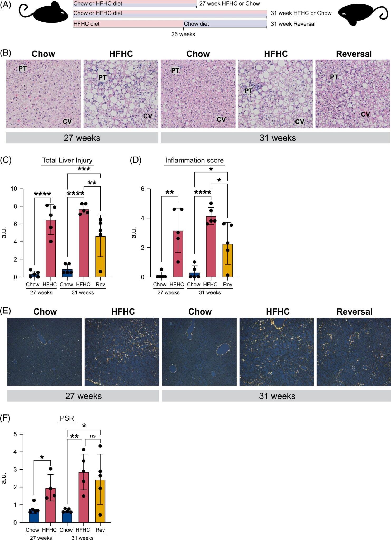 New research into fatty liver disease aims to help with early intervention