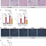 New research into fatty liver disease aims to help with early intervention