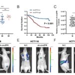 Research confirms that circZFR is a promising biomarker for the diagnosis and prognosis of colorectal cancer