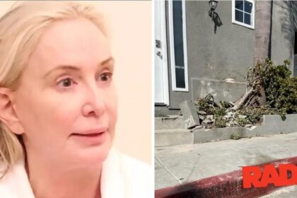 Shannon Beador's bloodied face from car crash revealed in shocking photo