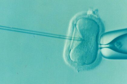 Time-lapse imaging for embryo selection in IVF does not improve the chance of a live birth, a major study shows