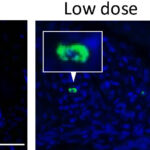 New compound shows great potential for patients with neutrophil-associated inflammation