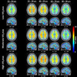 Research links cardiovascular fitness to brain health