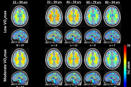 Research links cardiovascular fitness to brain health