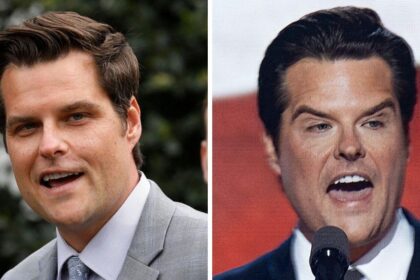 What happened to Matt Gaetz's face? See his shocking transformation