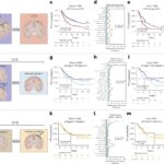 Molecular profiling can improve decision-making about meningioma