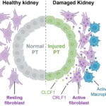 New research shows that cells become involved in unhealthy relationships after acute kidney injury in mice