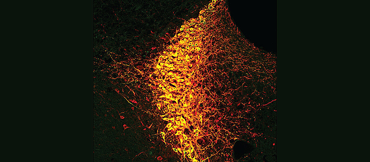 Research shows that the attentional state of the brain is determined by a handful of neurons